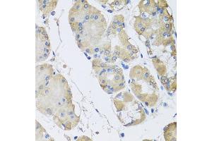 Immunohistochemistry of paraffin-embedded human gastric using RPLP1 antibody at dilution of 1:100 (x40 lens). (RPLP1 antibody)