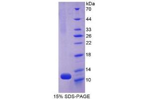 SDS-PAGE (SDS) image for Natriuretic Peptide A (NPPA) (AA 25-122) protein (His tag) (ABIN2120405) (NPPA Protein (AA 25-122) (His tag))