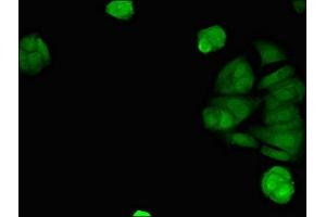 Immunofluorescent analysis of MCF-7 cells using ABIN7170794 at dilution of 1:100 and Alexa Fluor 488-congugated AffiniPure Goat Anti-Rabbit IgG(H+L) (STING/TMEM173 antibody  (AA 207-379))