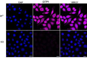 anti-Glutathione S-Transferase pi 1 (GSTP1) antibody