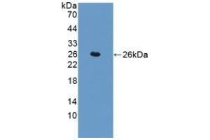 Detection of Recombinant TAGLN, Human using Polyclonal Antibody to Transgelin (TAGLN) (Transgelin antibody  (AA 1-201))