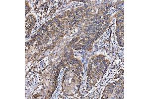 IHC analysis of SH2D4A using anti-SH2D4A antibody (ABIN7601695). (SH2D4A antibody  (AA 42-454))