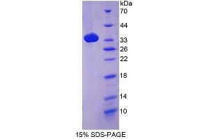 SDS-PAGE of Protein Standard from the Kit (Highly purified E. (Complement C4 ELISA Kit)