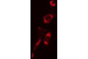 ABIN6266516 staining BJ cells by IF/ICC.