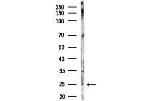 anti-NME/NM23 Family Member 5 (NME5) (C-Term) antibody