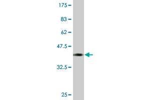 Western Blotting (WB) image for anti-CDC42 Binding Protein Kinase beta (DMPK-Like) (CDC42BPB) (AA 1580-1679) antibody (ABIN523071)