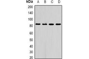 Western blot analysis of AFAP1 expression in A549 (A), HepG2 (B), mouse liver (C), rat liver (D) whole cell lysates. (AFAP antibody)