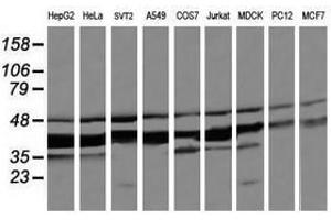 Image no. 1 for anti-Mitogen-Activated Protein Kinase Kinase 3 (MAP2K3) antibody (ABIN1499399) (MAP2K3 antibody)