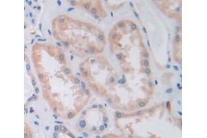 IHC-P analysis of Human Tissue, with DAB staining. (HGF antibody  (AA 495-728))