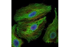 Immunofluorescence (IF) image for anti-PDZ Binding Kinase (PBK) antibody (ABIN969345)