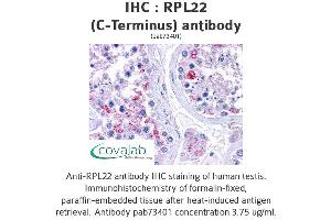 Image no. 2 for anti-Ribosomal Protein L22 (RPL22) (C-Term) antibody (ABIN1738940) (RPL22 antibody  (C-Term))