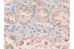 Detection of PLA1 in Human Kidney Tissue using Polyclonal Antibody to Phospholipase A1 (PLA1)