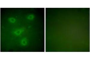 Immunofluorescence analysis of NIH-3T3 cells, using Keratin 14 Antibody. (KRT14 antibody  (AA 1-50))
