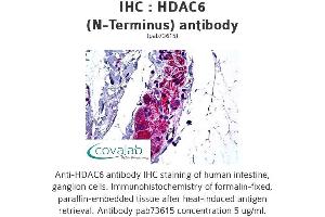 Image no. 1 for anti-Histone Deacetylase 6 (HDAC6) antibody (ABIN1735369) (HDAC6 antibody)