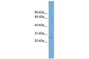 TINAGL1 antibody used at 1 ug/ml to detect target protein. (TINAGL1 antibody  (Middle Region))