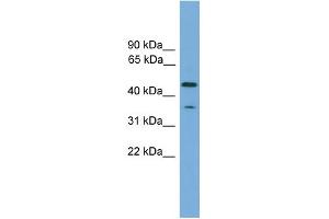 WB Suggested Anti-C6orf154 Antibody Titration: 0. (C6orf154 antibody  (N-Term))
