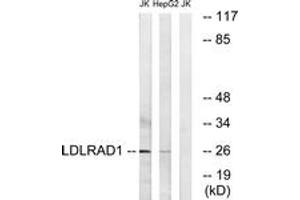 Western blot analysis of extracts from Jurkat/HepG2 cells, using LDLRAD1 Antibody. (LDLRAD1 antibody  (AA 84-133))