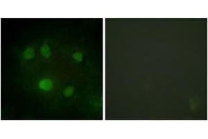 Immunofluorescence analysis of HeLa cells, using DDX5/DEAD-box Protein 5 (Ab-593) Antibody. (DDX5 antibody  (AA 565-614))