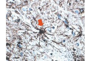 Formalin-fixed, paraffin-embedded section of human brain stained for GFAP. (GFAP antibody)