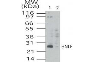 Image no. 1 for anti-Transmembrane Emp24 Protein Transport Domain Containing 4 (TMED4) (AA 55-67) antibody (ABIN208712) (TMED4 antibody  (AA 55-67))