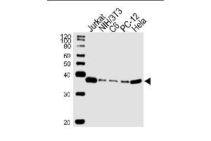 Lane 1: Jurkat Cell lysates, Lane 2: NIH/3T3 Cell lysates, Lane 3: C6 Cell lysates, Lane 4: PC-12 Cell lysates, Lane 5: Hela Cell lysates, probed with RAD51 (1281CT886. (RAD51 antibody)