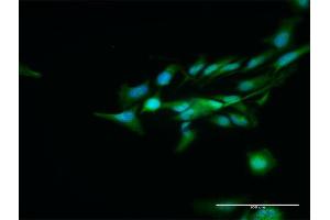 Immunofluorescence of purified MaxPab antibody to DCPS on HeLa cell. (DCPS antibody  (AA 1-337))