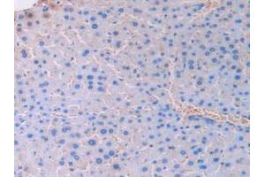 IHC-P analysis of Mouse Liver Tissue, with DAB staining. (UCN3 antibody  (AA 24-149))