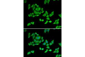 Immunofluorescence analysis of U2OS cells using OGDH antibody (ABIN6131413, ABIN6145002, ABIN6145004 and ABIN6216119). (alpha KGDHC antibody  (AA 148-427))