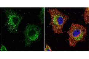 ICC/IF Image GSTP1 antibody [N1N2], N-term detects GSTP1 protein at cytoplasm by immunofluorescent analysis. (GSTP1 antibody  (N-Term))