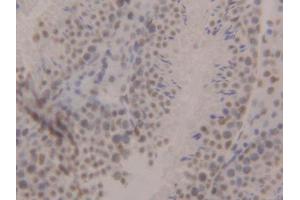 DAB staining on IHC-P; Samples: Mouse Testis Tissue (CBX3 antibody  (AA 1-183))