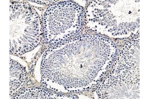 ABIN7096341 and ABIN7100403 at 1/100 staining rat testis tissue by IHC-P. (VCY, VCY1B antibody)