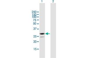 Western Blot analysis of MESDC2 expression in transfected 293T cell line by MESDC2 MaxPab polyclonal antibody. (MESDC2 antibody  (AA 1-234))