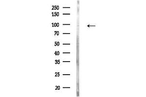 anti-Zinc Finger Protein 281 (ZNF281) (Internal Region) antibody