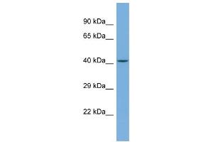 Host:  Rabbit  Target Name:  TRIM49C  Sample Type:  Jurkat Whole cell lysates  Antibody Dilution:  1. (TRIM49C antibody  (N-Term))