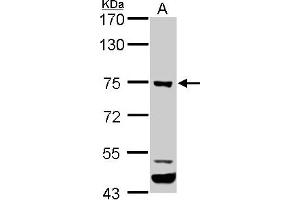 WB Image ELMO1 antibody [C3], C-term detects ELMO1 protein by western blot analysis. (ELMO1 antibody  (C-Term))
