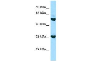 Western Blotting (WB) image for anti-Major Histocompatibility Complex, Class II, DO beta (HLA-DOB) (N-Term) antibody (ABIN2788876) (HLA-DOB antibody  (N-Term))