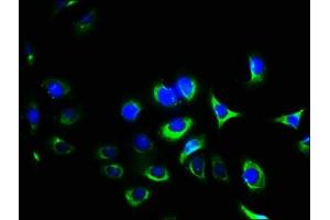 Immunofluorescence staining of A549 cells with ABIN7156456 at 1:400, counter-stained with DAPI. (Integrin Alpha2b antibody  (AA 639-887))