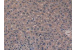 IHC-P analysis of Rat Liver Tissue, with DAB staining. (Meprin B antibody  (AA 433-679))