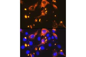Immunofluorescence analysis of NIH-3T3 cells using GLUT2/SLC2 Rabbit mAb (ABIN7270414) at dilution of 1:100 (40x lens). (SLC2A2 antibody)