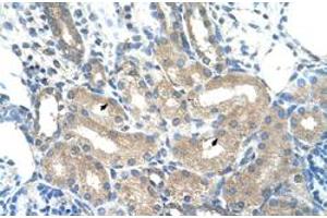 Immunohistochemical staining (Formalin-fixed paraffin-embedded sections) of human kidney with ADH1B polyclonal antibody  at 4-8 ug/mL working concentration. (ADH1B antibody  (C-Term))