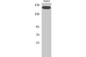 Western Blot (WB) analysis of specific cells using Phospho-Flk-1 (Y1214) Polyclonal Antibody.