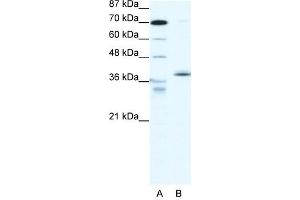 Western Blotting (WB) image for anti-Nuclear Receptor Subfamily 2, Group F, Member 6 (NR2F6) (N-Term) antibody (ABIN182517) (NR2F6 antibody  (N-Term))