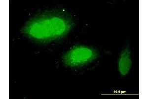 Immunofluorescence of monoclonal antibody to WDR79 on HeLa cell. (WRAP53 antibody  (AA 62-160))