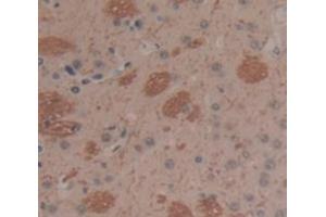 Immunohistochemistry (IHC) image for anti-Cyclin-Dependent Kinase 2 (CDK2) (AA 94-212) antibody (ABIN1175177)