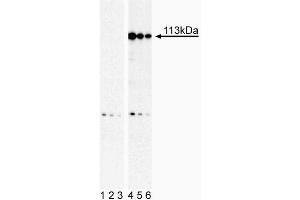 Western Blot analysis of Stat2 (pY690) in human histiocytic lymphoma. (STAT2 antibody  (pTyr690))