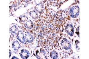 IHC-P: Bid antibody testing of rat intestine tissue (BID antibody  (AA 1-195))