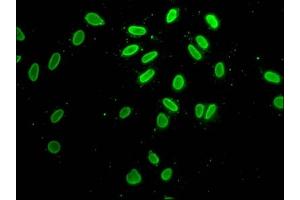Immunofluorescence staining of Hela cells with ABIN7139193 at 1:25, counter-stained with DAPI.