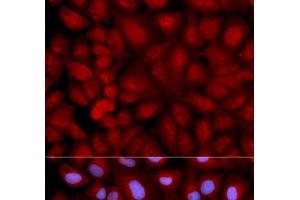 Immunofluorescence analysis of U2OS cells using SNCG Polyclonal Antibody (SNCG antibody)