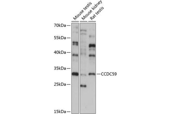 CCDC59 antibody  (AA 1-241)