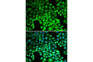 Immunofluorescence analysis of U2OS cells using PSMA4 antibody. (PSMA4 antibody)